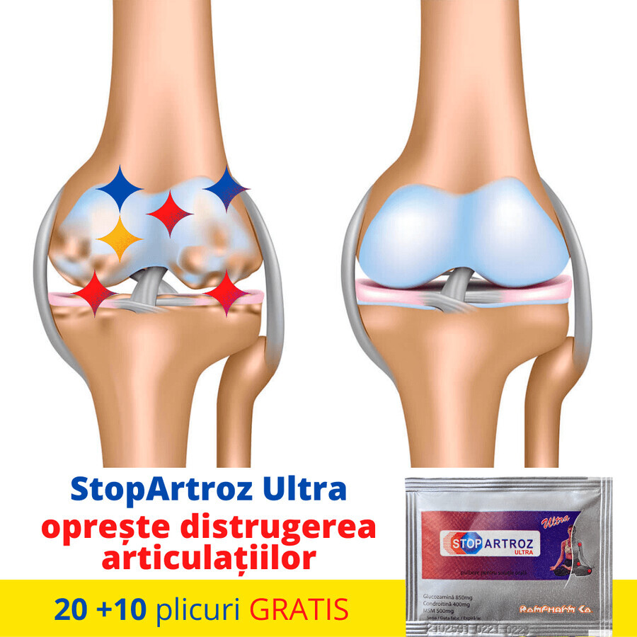 Stopartroz Ultra, 30 plicuri, Rompharm