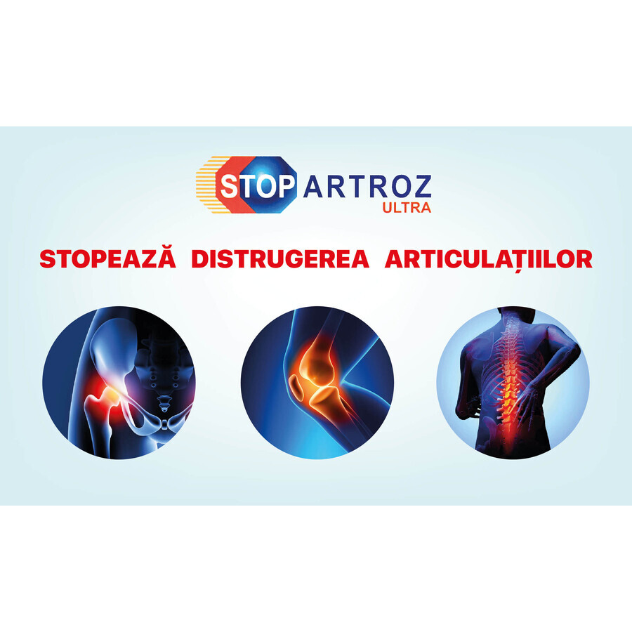 Stopartroz Ultra, 30 plicuri, Rompharm