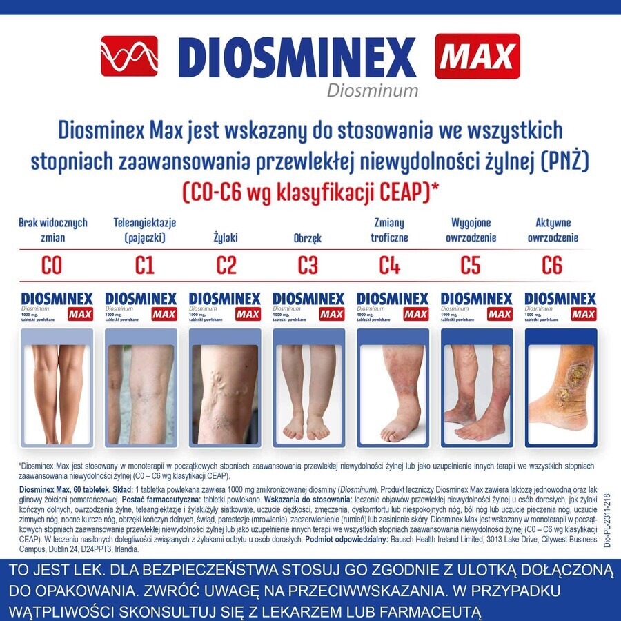 Diosminex Max 1000 mg, 60 comprimidos