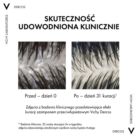 Vichy Dercos Anti Dandruff DS, Anti-Schuppen-Shampoo, trockenes Haar, 390 ml