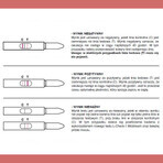 L-Check-1 Midstream Ovulationstest, 1 Packung (5 Tests)