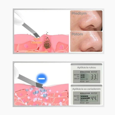 TouchBeauty 1887 Ultradźwiękowa szpatułka do twarzy: ceny i cechy