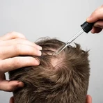 Scandinavian Biolabs® Bio-Pilixin® Activation serum for slowing hair loss and promoting hair growth for men 100 ml