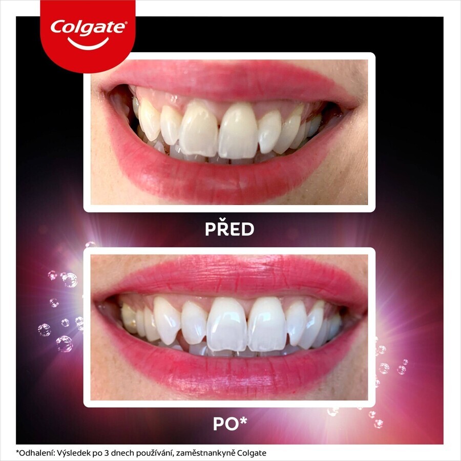 Colgate Max White Ultra Fresh Pearls aufhellende Zahnpasta 50 ml