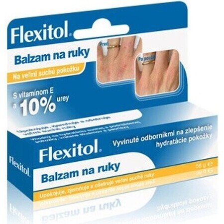 FLEXITOL HAND BALM 1×56 g, trockene Handhaut