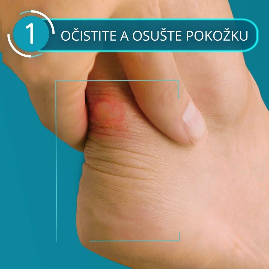 Compeed Plasture mittel Blister 5 Stück