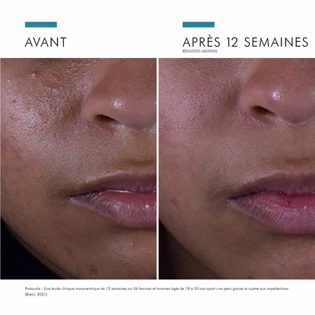 Skinceuticals Silymarin CF Ser antiimperfecțiuni pentru față 30ml