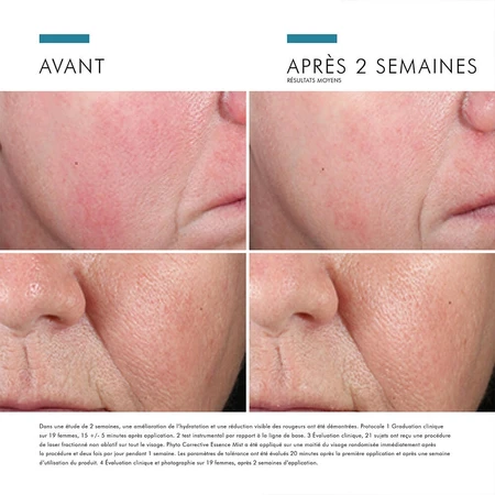Skinceuticals Phyto Corrective Essence Mist Ceață calmantă pentru pielea sensibilă 50ml