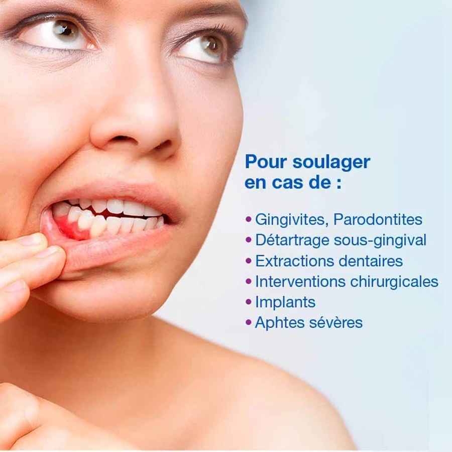 Hyalugel Forte Perio Gel bucal asanant Acide Hyaluronique 1.2% 8ml
