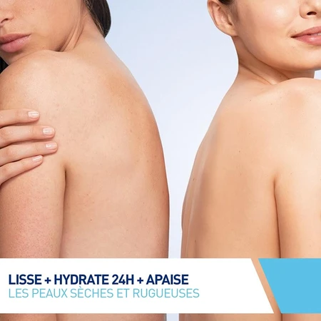 Cerave Body SA Gladmakende Crème 10% Urea en Salicylzuur Droge Huid 340g