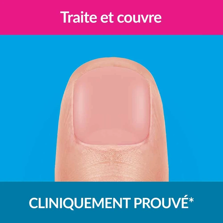 Excilor Nail Fungus Treatment Strong Nude Colouring 30ml