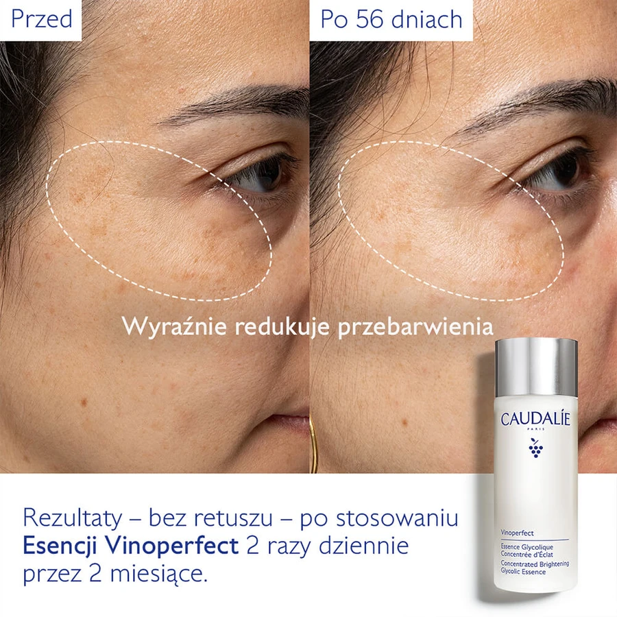 Caudalie Vinoperfect, esență glicolică concentrată pentru a adăuga strălucire, 100 ml