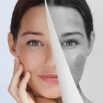 Miraculum Anti-Pigmentation, krem pod oczy rozjaśniający cienie, 15 ml: ceny i cechy