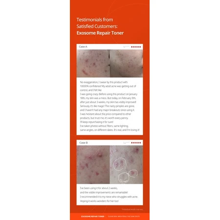 Dr.Melaxin Exosome Repair Toner, toner reparator cu exosomi, 300 ml