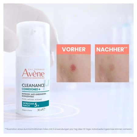 Avène Cleanance piele cu imperfecțiuni 1 set