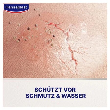 Hansaplast Zweite Haut Schutz Flüssig-pfl.konz. 10 ml
