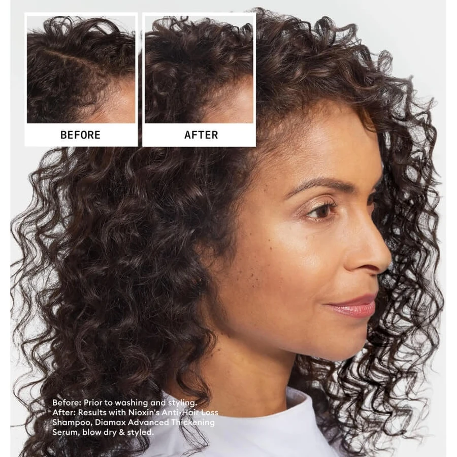Nioxin Anti-hair loss - șampon împotriva căderii părului 240 ml