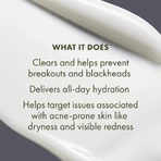 Origins Clear improvement blemish clearing hydrating lotion - lozione idratante anti-imperfezioni 50 ml