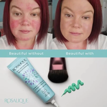Rosalique 3-in-1 Anti-Roodheid SPF 50 Wonderformule - Anti-Roodheid Gezichtscreme 30 ml