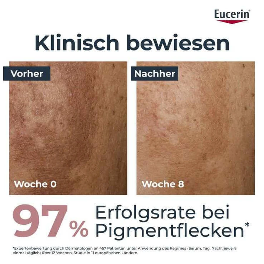 Sérum dual antipigmentación Eucerin - Manchas oscuras, crema de 2 x 30 ml