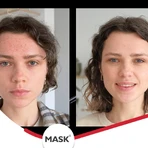 Mask Plus Acne Gel, 2x30 ml, Solartium